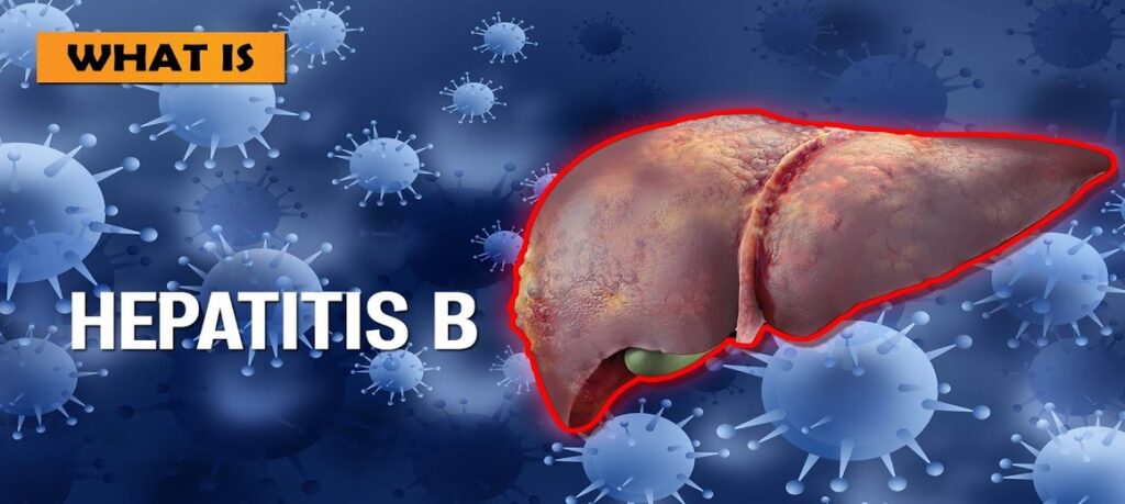 What Is Hepatitis B - International Gastro Institute